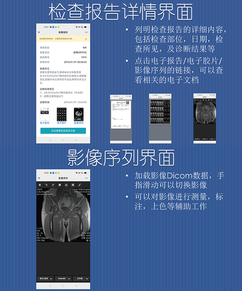 醫(yī)院放射透視檢測報(bào)告電子膠片檢查報(bào)告云管理系統(tǒng)軟件開發(fā)APP小程序定制 醫(yī)院放射透視檢測報(bào)告電子膠片檢查報(bào)告云管理系統(tǒng)軟件開發(fā)APP小程序定制