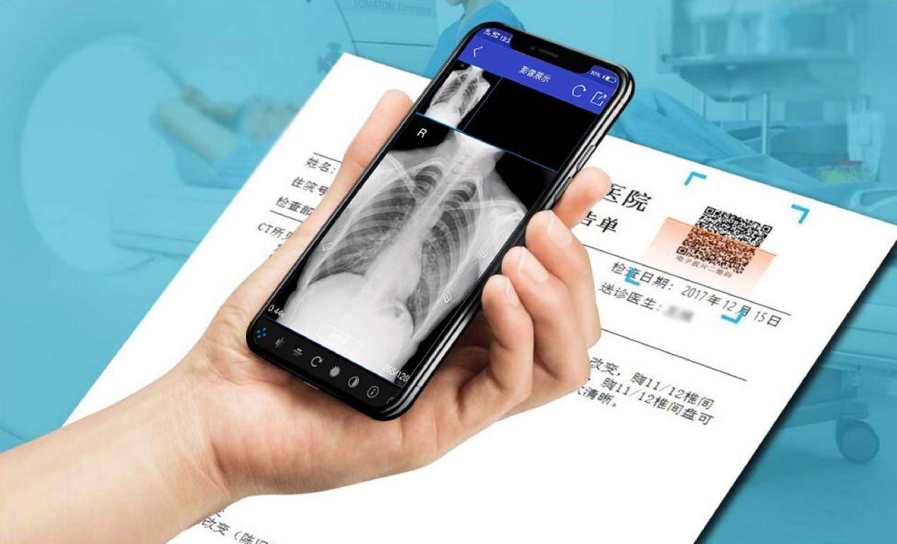 云膠片是什么？